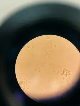 #CapCut #microbiology #microbiologia #laboratorioclínico #laboratorio #viralvideos #paratii #fypシ゚ #edits 