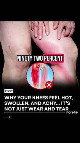 Do this for neuropathy #neuropatia #neuropathy #healthy #sciaticarelief #health #jointpain #healthylifestyle 