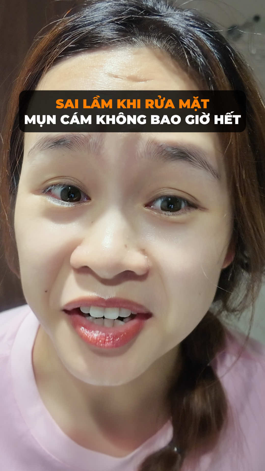 Ê ê ê !!! Mụn cám nhiều thì check var ngay cho chị rồi áp dụng cách c chỉ nhá, đỡ mụn cám lắm đó nha #hoangngoan #congoanchamda #muncam #dcgr 