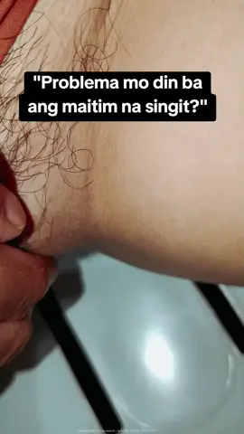 problema mo din ba nag maitim na singit? Dermorepubliq 5% Niacinamide + hyaluronic acid for sensitive skin formula  Dermorepubliq niacinamide  Dermorepubliq official store  Dermorepubliq  Dermorepubliq set skin care Dermorepubliq review honest  Dermorepubliq serum Dermorepubliq for dark spots  #dermorepubliq #dermorepubliqserum #serum #niacinamide #dermorepubliqskincare #skincare #skincareroutine #skincareproducts #dermorepubliqniacinamideserum #dermorepubliqniacinamide #fyp #fypage #viral 