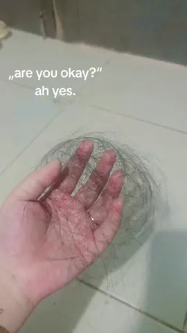 rasanya pengen botakin aja kalo sekali nyisir aja sampe segini banyaknya, di lantai pun berserakan dmn mna pasti ada rambut yang rontok😌....  #fypage #fypシ #fyppppppppppppppppppppppp #rambutrontokparah #rontok #tipsrambutrontok 