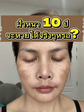 “ไม่ได้อยากสวย แค่อยากกลับมามั่นใจอีกครั้ง” วัย 40+ เคยหมดหวังกับหน้าตัวเอง แต่งหน้าก็ไม่สวย ถ่ายรูปคนก็ทักหน้าเป็นอะไร ทำให้เราขาดความมั่นใจมากๆ กลายเป็นไม่ชอบถ่ายรูป ไม่แต่งตัว ไม่อยากไปไหน ใครเจอแบบเดียวกันบ้างคะ #ฝ้ากระ ###รักษาฝ้า#ผิว ##ผิวหน้า #ดูแลผิว ##cosmelan ##CapCut
