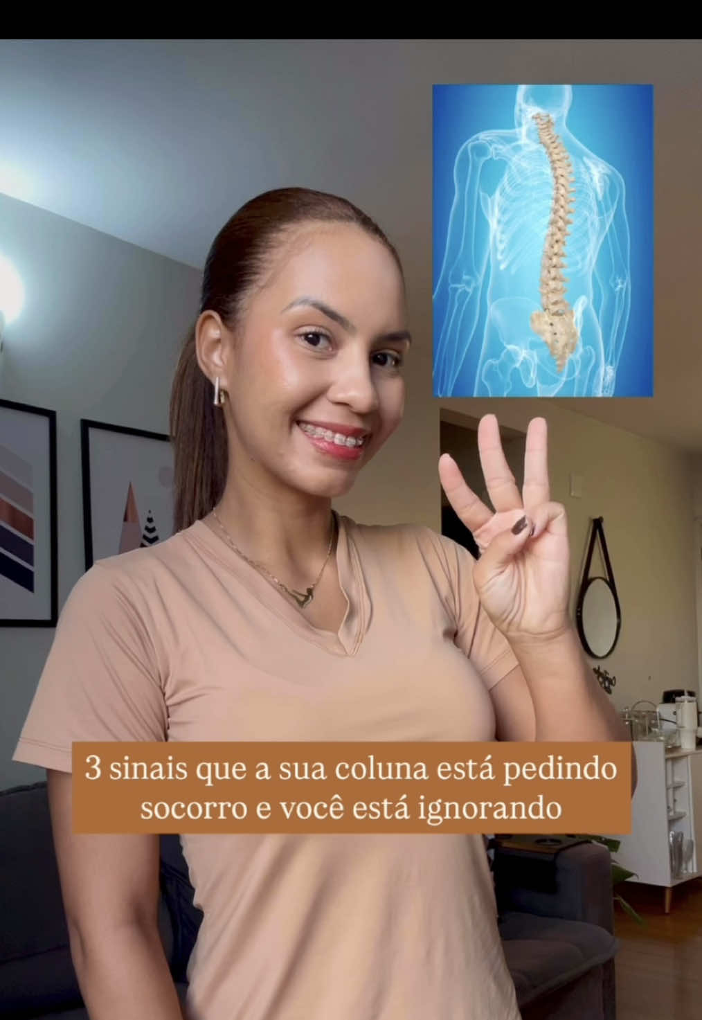 Você sente dores nas costas, mas não faz ideia de como aliviar isso no dia a dia? Então presta atenção nesses 3 sinais de que a sua coluna tá pedindo socorro (e você talvez esteja ignorando): 1️⃣ Ficar sentado por muitas horas sem pausas. 2️⃣ Dificuldade de manter a postura. 3️⃣ Dificuldade pra levantar da cama, sofá ou carro. Esses sinais não são normais. Eles mostram que o seu corpo tá pedindo movimento certo, com consciência e leveza. ✨ E o melhor? Dá pra começar com exercícios simples, em casa mesmo! 💬 Comenta “PILATES” se você quer aprender exercícios de Pilates pra fazer em casa e aliviar esses desconfortos.