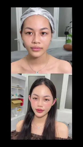 From mặt baby 𝗧𝗿𝘂𝗻𝗴 𝗛𝗼𝗮 nhà em Hiền đây ạ, không khác gì gái Trung luôn ❤️❤️✔️ Bạn nào thích form mặt baby Trung Hoa thì liên hệ em để sở hữu gương mặt giống mấy tỉ tỉ 𝘾𝙝𝙞𝙉𝙖 nhé✔️Kỹ thuật tiêm độc quyền, giúp gương mặt thon gọn, chống tình trạng chảy xệ — Tốn ít filler —> Filler xịn, đạt tiêu chuẩn (bao check thuốc) #filler #botox #trảngbàng_tâyninh_70 