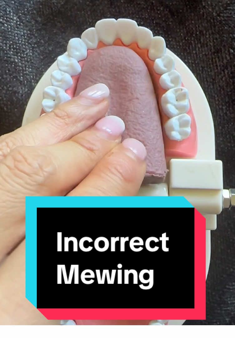 You're mewing wrong if you're pressing your tongue on your teeth. The sweet spot is right behind the upper front teeth—not on them! #KokoFaceYoga #FaceYoga #MewingMistakes #SweetSpot #TonguePosture #TCHAwareness #JawlineTips #NoHardMewing