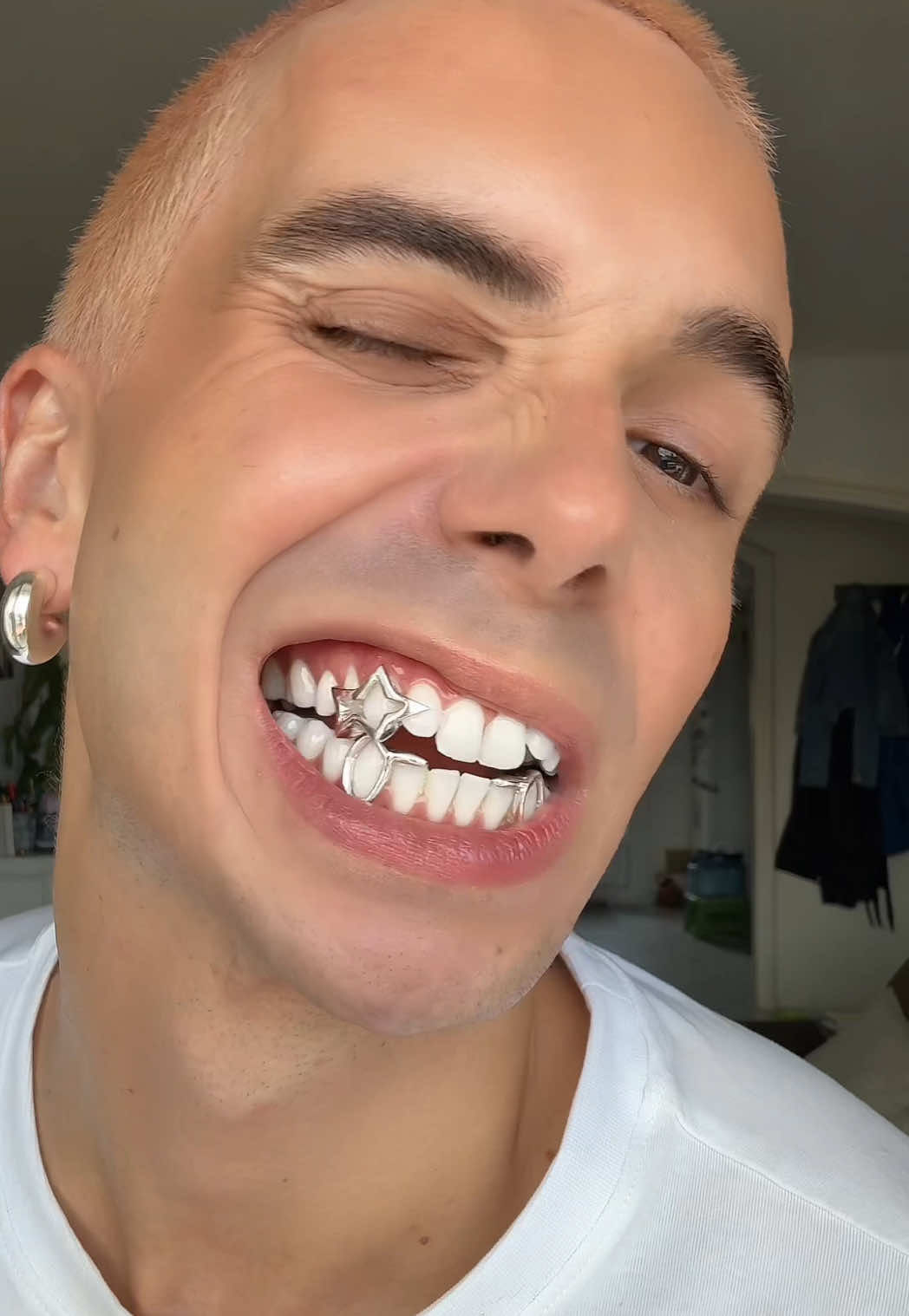 nouveaux grillz pour l’été ✨ on valide? 🖤