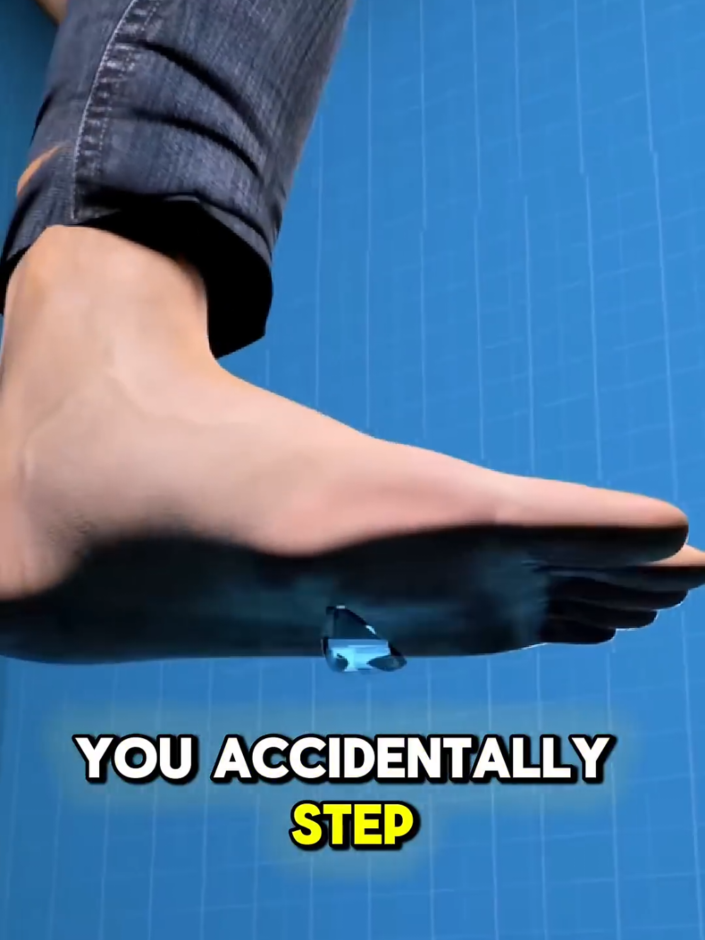 You accidentally stepped on glass? Herea what to do immwdiately #fyp #firstaid 