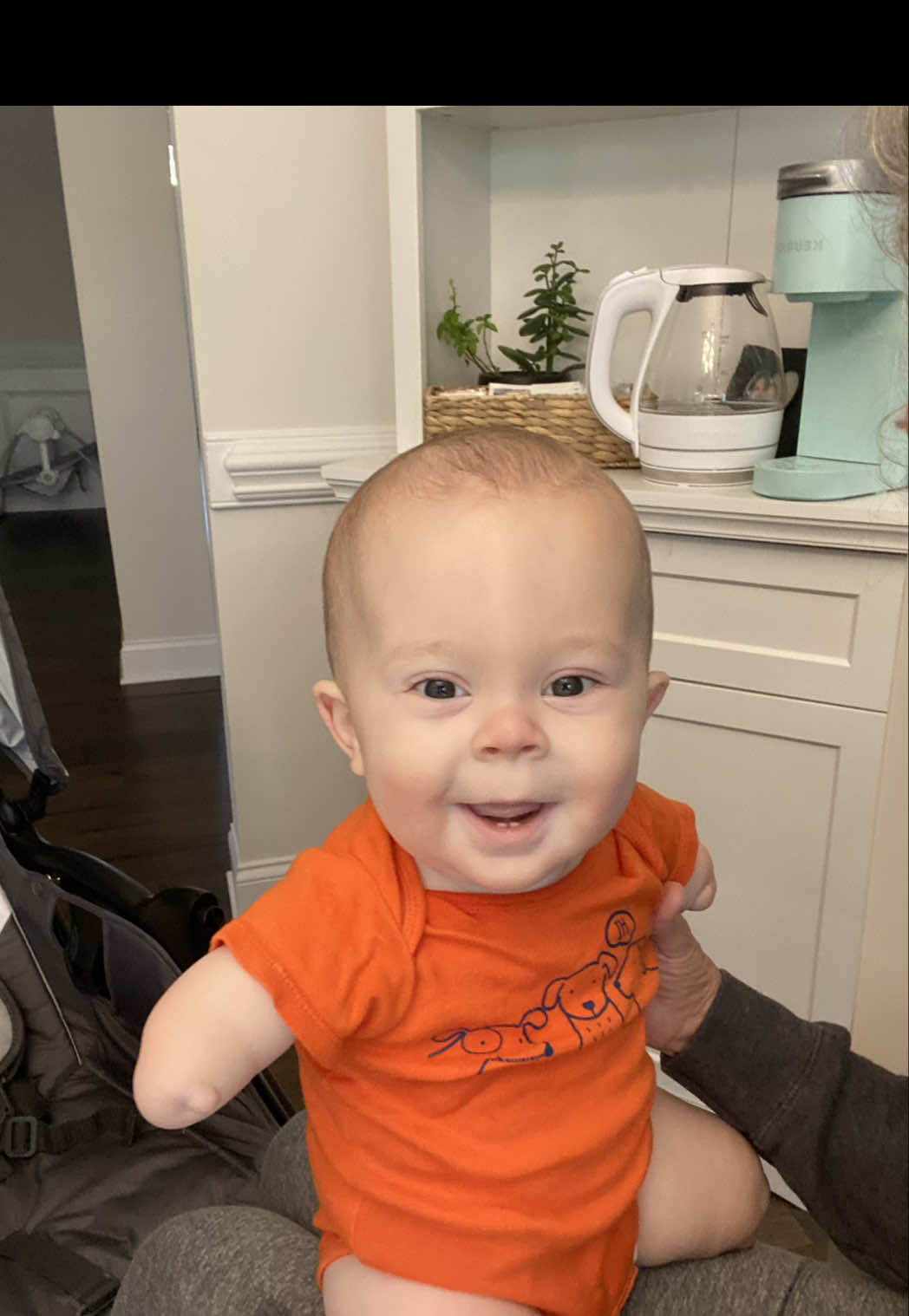 I swear we have the funniest kid who can’t talk lol #fyp #starfish #foryou #limbdifference #limbdifferenceawareness #prosthetics #paralympics #adaptive #dayinmylife #dayinthelife #prosthetics #luckyfin #tiktokscenescontest 