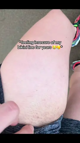 Bikini line glow up 👀  #shaving #shavingtips #skincare #hairremoval #safetyrazor #ecorazor #nz #newzealand #australia #shavinghacks #razorburn #strawberrylegs