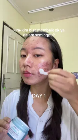 skintific 5x ceramide aaaagggaaaiiiinnnn😗😗 #acne #acneskin #acneproneskin #acnefighter #jerawat #jerawatan #pejuangjerawat #moisturizer #skintific #5xceramide #skinbarrier #skinbarrierrepair 