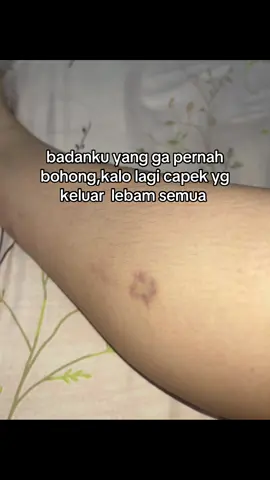 Biru biru semua kakinya  #fyp #fypシ゚viral #xyzbca 