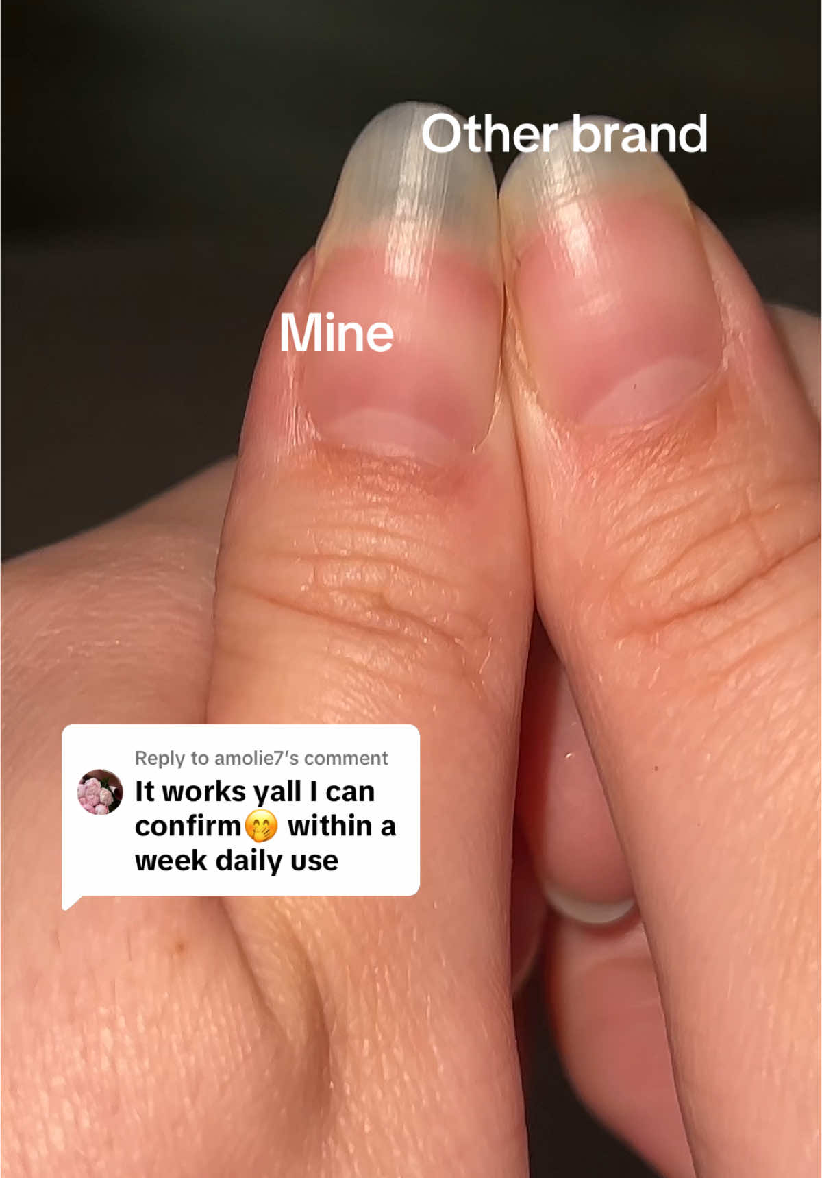 Replying to @amolie7 #nailgrowth #nails #nailsoftiktok 
