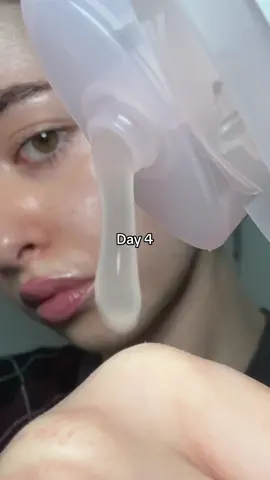 Hydration is key 🤭✨ reducing the appearance of pores using @SKIN1004 US centella poremizing light gel cream  #pores #blackheads #poreminimizing #poremizing #overnightcream #skincareroutine #skincareproducts #koreanskincare #tiktokmademebuyit #skin1004 #centella #skin1004partner 