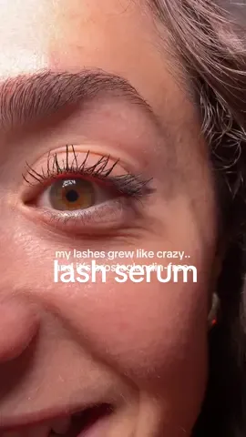 this lash serum made my lashes grow so long… and it’s prostaglandin-free, so no irritation or scary side effects. linked it for you on tiktok shop! #tiktokshop  #tiktokmademebuyit #lashserum #longlashes #prostaglandinfree #BeautyTok #lashgrowth