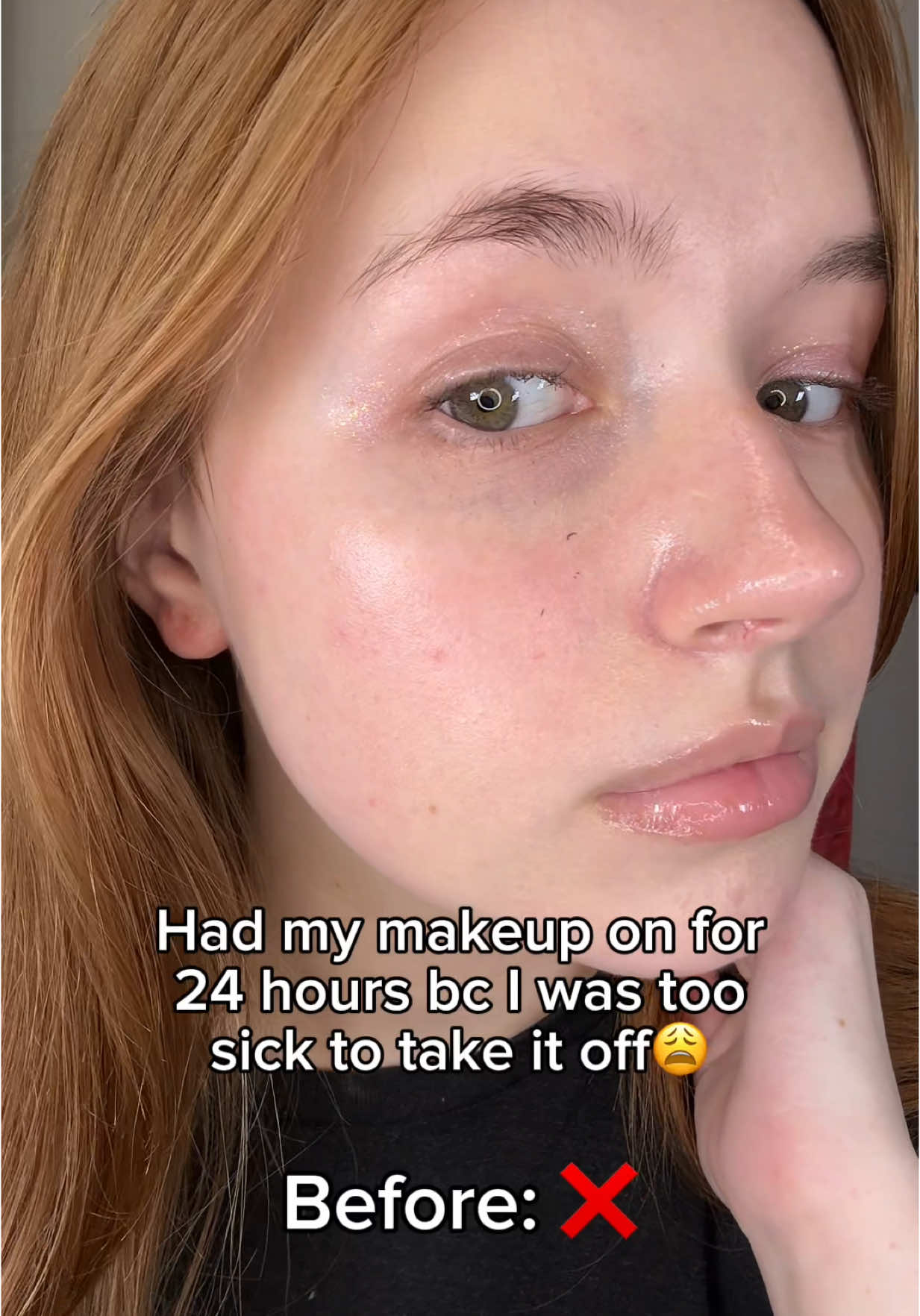 5-Step skincare routine while sick🤧✨ #skincareroutine #koreanskincare #skincare #koreanskincareroutine #glassskin #yesstyle #mixsoonskincareroutine #skintok #kbeauty #mixsoon #fyp #fypage #viral @mixsoon 