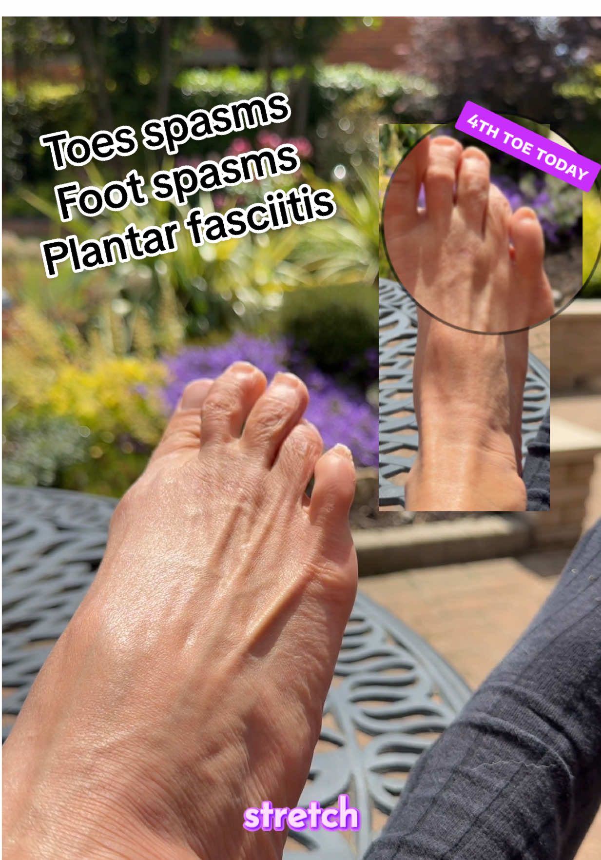 #fibromyalgiasymptoms #footspasms #plantarfasciitis #chronicpainlife #chronicpainwarrior #hypermobilespectrumdisorder #toespasm #fibromyalgiaawareness 