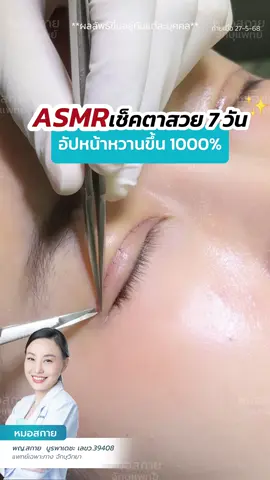 ASMR เช็คตาหวานครบ 7 วัน ✨ #หนังตาเยอะ #asmr #กล้ามเนื้อตาอ่อนแรง #ตาง่วง #ตาปรือ  #หมอสกาย #จักษุแพทย์ #หมอตา #skyclinic  #ศัลยกรรมตา #รีวิวตาสองชั้น #สกายคลินิก  #ทำตาที่ไหนดี