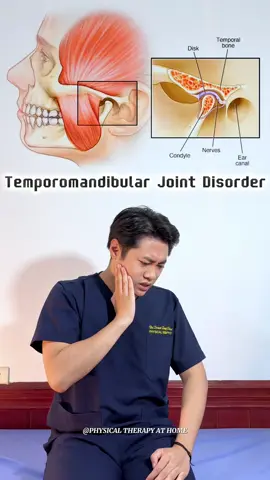 Temporomandibular joint disease is a complex disorder that affects the joint between the jaw and skull, resulting in pain, stiffness, and limited joint mobility. This condition not only makes it difficult to eat, speak, and perform daily activities, but also greatly affects the quality of life. #physicaltherapy #exerciseathome #rehabilitation #pain #temporomandibular #mouthpain #mouth #headache 