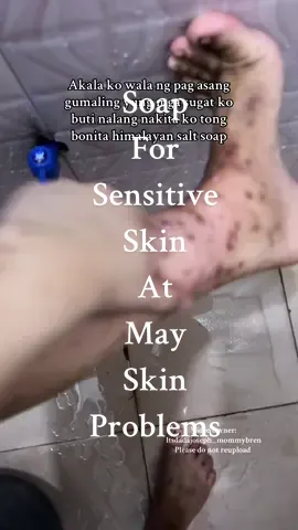Effective to sa mga sugat ko grabe subukan nyo #bonita #bonitahimalayansaltsoap #bonitasoap #himalayansaltsoap #himalayansoap #himalayan #beautysoap #acnesoap #sensitiveskinsoap #soap #soapforsensitiveskin #sabon 