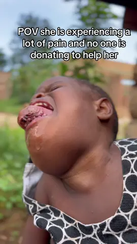 Even 5$ helps donate today to help Shamirah fight cancer ♋️ #usa🇺🇸 #donate #suppport #unitedkingdom #german #france🇫🇷 #canada_life🇨🇦 