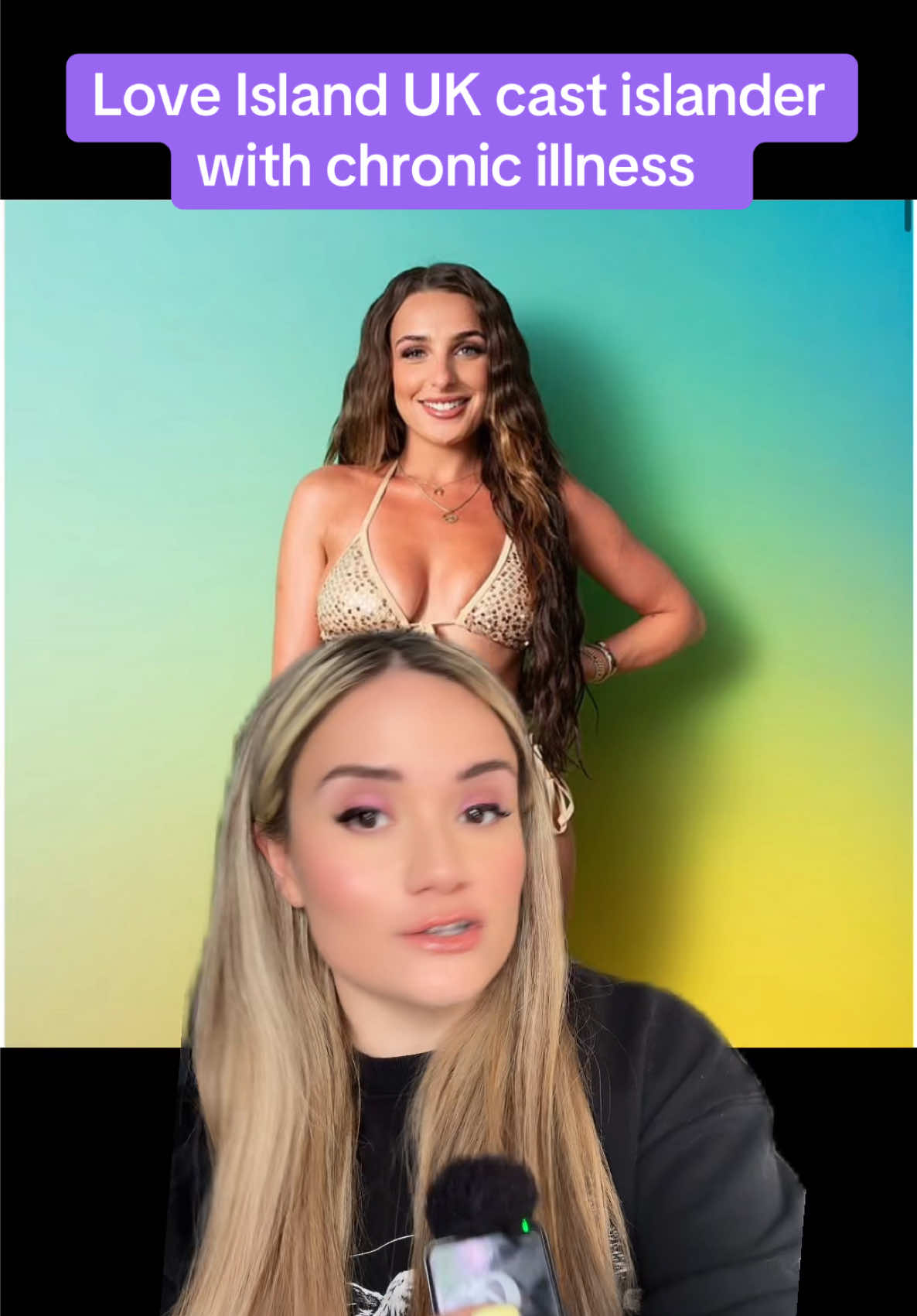 Love Island UK cast islander with chronic illness  #loveislanduk #LoveIsland #loveisland2025  #whattowatch #fyp #tv #series