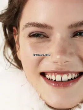 #recommendations #girls #beauty #diastema #teeth #smile 