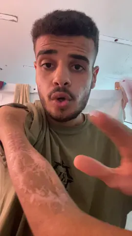 Save Mahmoud and his hand ‏#fyp #fup #viral #foryoupage #govirall #fypsy #fypg #fyyyp #frp #kids #business #fyyy #f #fyp #foryou ##foryoupage #fypppppppppppppppppppppppppppppppppp #viral #water #Home #food #job #usa #indonesia #dubai🇦🇪 #unfrezzmyaccount #support_me #dubaichocolate #foryou #fypシ #foryoupage #viralvideo #trend #explore #Love #support #helpme #life #family #saveus #tiktok_arab #palestine #rebuild #hope #future #dubai #usa #indonesia #tiktok #tiktokviral #fypdaily #momlife #baby #reallife #savelives #war #refugees #recovery #motherhood #voice #gaza #prayforus #helpnow #emergency #humanity #peace #rebuildhope