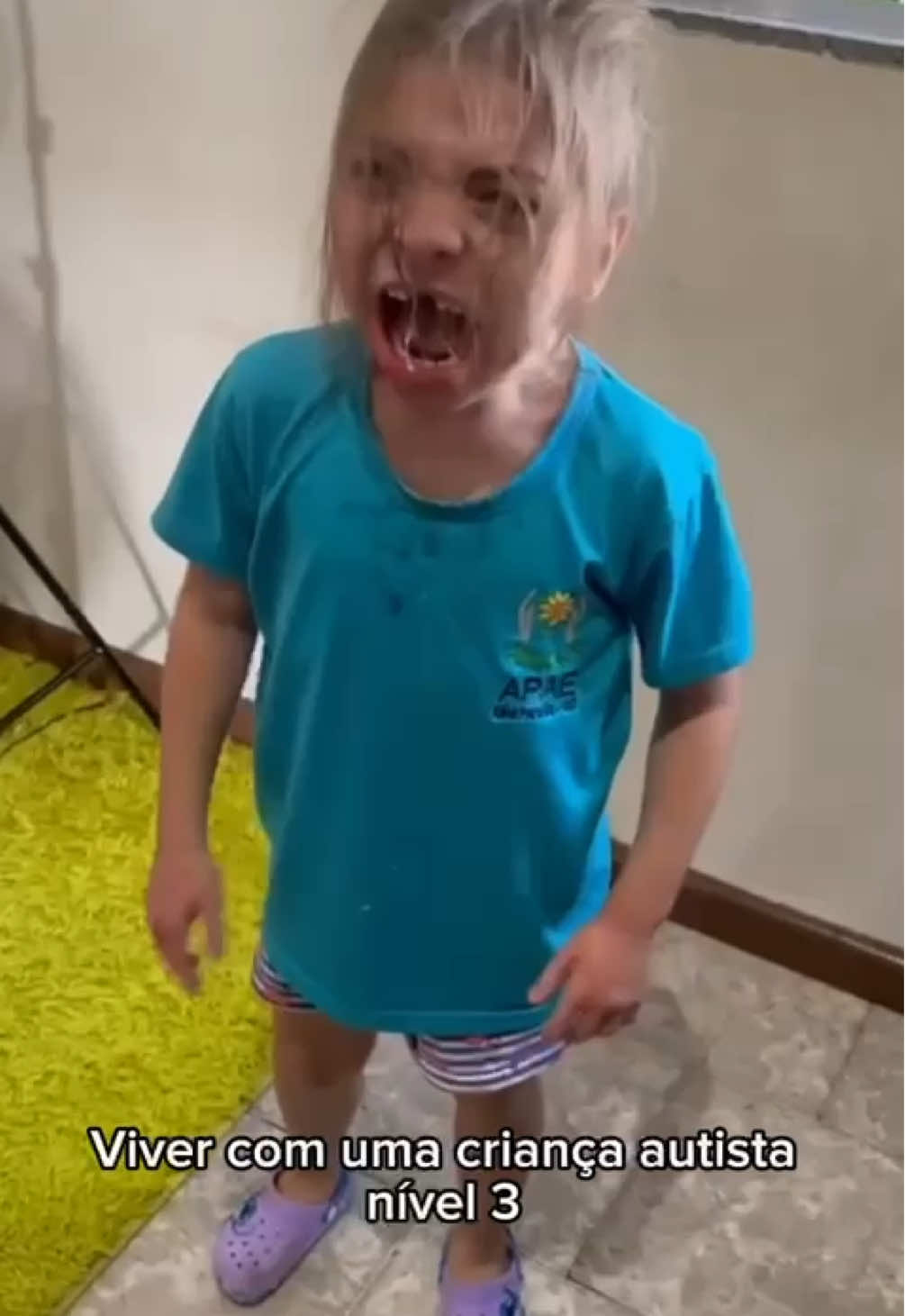#maeatipica #autismonivel3 #autismoreal #viralditiktok #titokbrasil #fyp #lutadiaria #autismosevero #