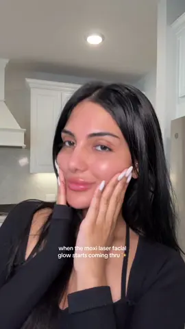 Youuuuu guys I would do this laser facial 10x’s if I could, I’m sold #moxilaser #moxilasertreatment #facial #houston #westu #skincare #fyp #fypage 