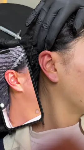 Làm tí tai tài lộc đi các ce ơi 🥰🥰🥰#Tiemmoi #haiphong #Filler #tiemmoidep #TiêmBotox #haiphongphoto #FillerUyTin #fillers💉 #Tiemthongon #fillerbotox_HP 