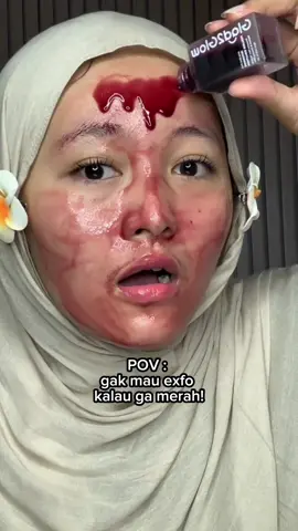 peeling serum yang cocok buat pemula 🫵🏻✨ MINIM CEKAT CEKIT!! #PeelingSolution #G2GPeelingSolution #trending 