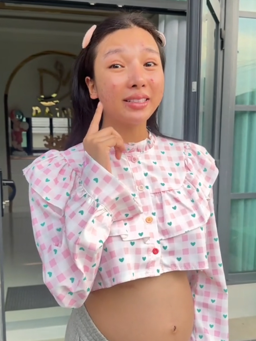 สิวขึ้นหนักมาก เทสเองนานหลายเดือน!!#เอิร์นไดเม่ #เซรั่มไดเม่ #ครีมไดเม่ 