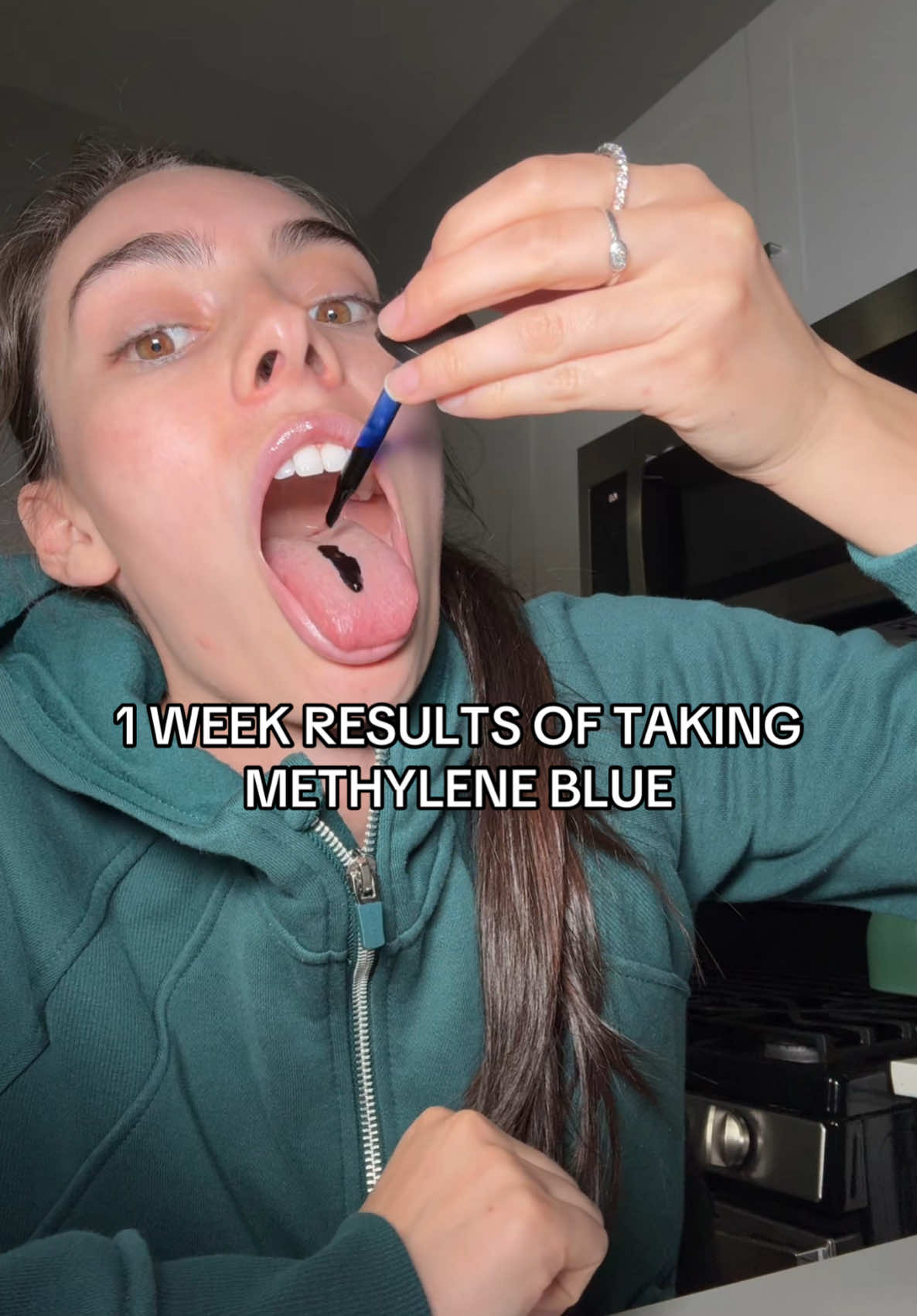 My own results 1 week in of taking methylene blue! Wasn’t expecting my mood to be so good and to be so focused and locked in! I will update after the 2 week mark! #methyleneblue #methylenebluetreatment #methylenebluebenefits 