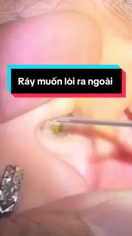 Tai nữ, ráy muốn lòi ra ngoài#raytai #xuhuong 