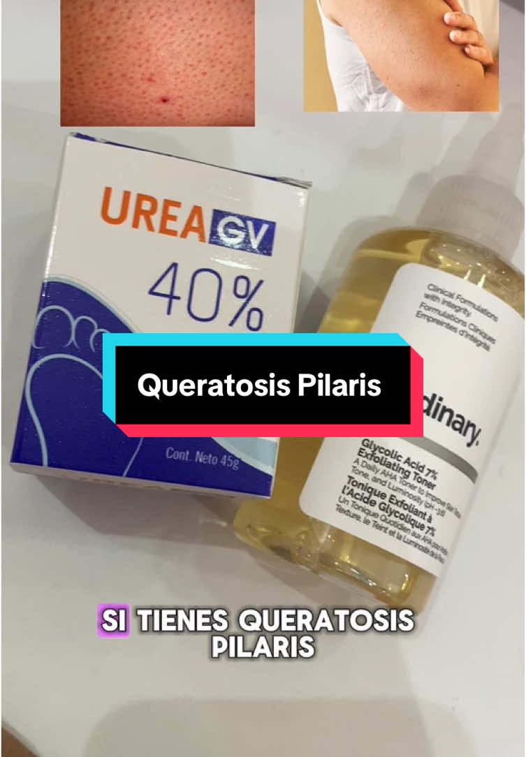 Productos recomendados para la Queratosis pilaris (piel de gallina). Crema de urea 40% + ácido Glicolico. 