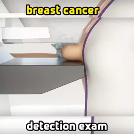 Mammography breast cancer detection exam #foryoupage❤️❤️ #videoviral 