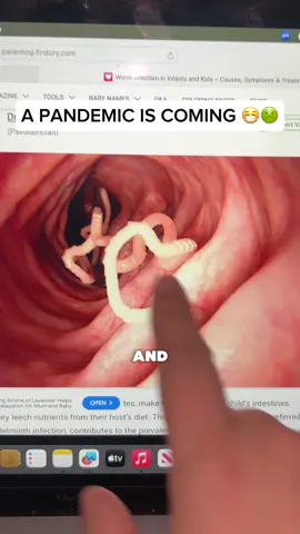 This could be serious 🤢 #superninja #flytrap #fruitflies 