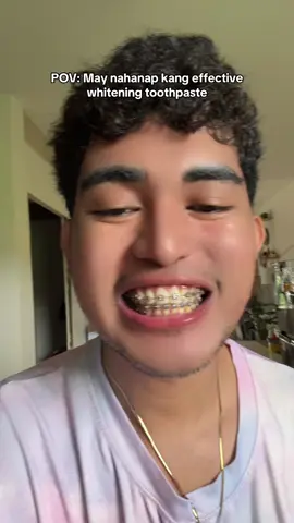 TIGNAN NGA NATIN 🦷🪥