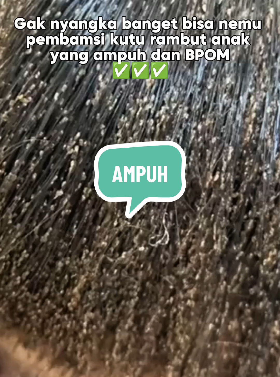Gak nyangka banget bisa nemu pembamsi kutu rambut anak yang ampuh dan BPOM✅✅✅ #kutu #obatkutu #minyakrambutpembasmikutu #kuturambutanak #fyp #fyppppppppppppppppppppppp #kuturambut #fypシ゚ #wibgajian #shinelooks 