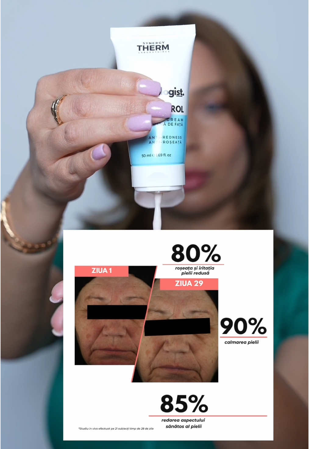 Spune adio roșeții și iritațiilor cu noua Rosa Control! Formulată special pentru pielea sensibilă și predispusă la roșeață, crema Rosa Control calmează,hidratează și reechilibrează tenul reactiv, zi de zi. Conține Niacinamidă, Neutrazen și Defensil Plus – ingrediente active cu efect antiinflamator și calmant Hidratează profund cu Exo-H, lăsând pielea suplă și confortabilă  Textură ușoară, cu absorbție rapidă – nu încarcă pielea Fără parfum, alcool, silicon sau parabeni Potrivită pentru utilizarea zilnică pe pielea sensibilă Rezultate vizibile după 29 de zile de utilizare regulată*: 19,61% reducere medie a eritemului 80% au observat reducerea roșeții pielii 80% au remarcat diminuarea iritațiilor 90% au simțit o calmare a pielii și mai puțin disconfort 85% au remarcat un aspect mai sănătos și revitalizat al pielii Rosa Control este alegerea ideală pentru un ten uniform, echilibrat și confortabil, fără compromisuri. *Test clinic in vivo, efectuat pe 20 de subiecți, timp de 29 de zile.  #rosa #rosacontrol #skincareroutine #skincareproducts