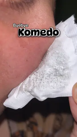 Best kali wee pas turun harga @Breylee.id #breylee #skincare #komedo #fypsounds 