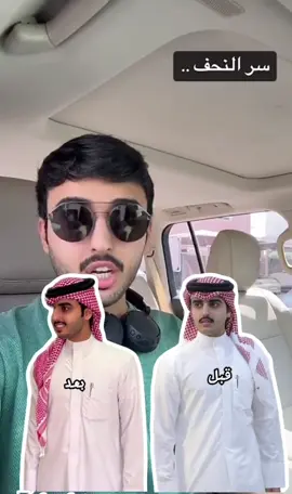لو يكمل شوي يختفي 👩🏻‍🦯😞 #خالد_ال_زايد 
