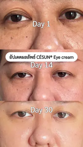 เป็นมากกว่า eye cream ไปแล้ว #รีวิวจริง ไม่เกินจริงเลยที่ริ้วรอยและใต้ตาเราดีขึ้นเราจะดูดีขึ้นดูอ่อนวัยขึ้น อยากให้ทุกคนเปิดใจลอง ไม่ใช่แค่แอร์ที่เห็นผล แต่คนอื่นๆที่ใช้ก็คือชอบมากๆ #อายครีม #eyecream #รีวิวสกินแคร์ #skincare #แม่แอร์ 