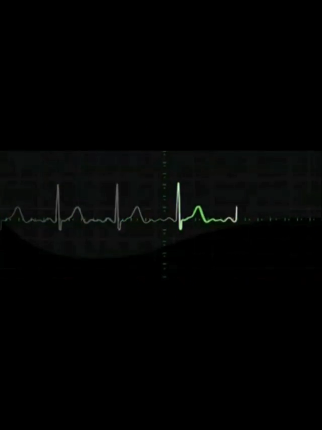 Exatamente....❤️