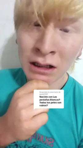 Respuesta a @ayuda1929 #dyzulilex #albino 