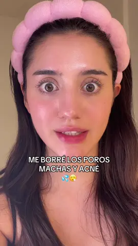 Dile adiós, a los poros, manchas y acné con esto ! 💦  ##skincare##skincarecoreano##kbeauty##cuidadodelapiel##poros##serum