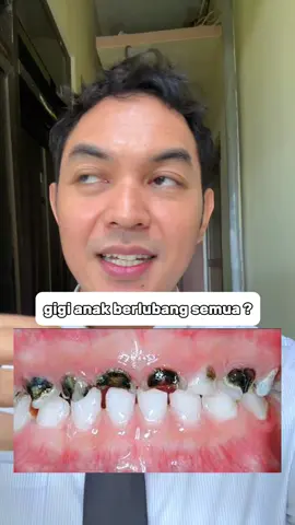 Rampan karies adalah bentuk karies yang terjadi dengan cepat dan meluas pada beberapa gigi, terutama pada anak-anak. Kondisi ini ditandai dengan kerusakan gigi yang parah dalam waktu singkat, seringkali menyerang gigi susu dan melibatkan beberapa gigi sekaligus