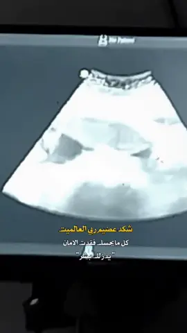 #CapCut #بنيتي #روحي 🫂🩷