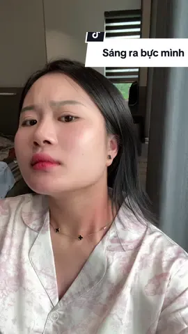 Thi thoảng vui vui lại bị đỏ bị ngứa #mebexiuxiu #sodermix #viemdacodia #tổ_đỉa #chàm_sữa