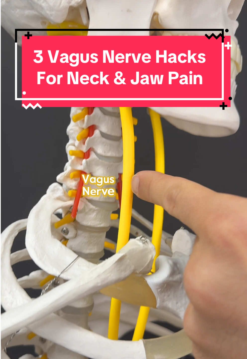 Headaches, jaw pain, brain fog, or neck tension that won’t let up? Your vagus nerve might be the missing link. It’s the body’s main calming pathway — running from your brain through your neck, chest, and gut. When it’s stuck in fight-or-flight, muscles stay tight, nerves stay irritated, and pain becomes your new normal. Try these 3 simple vagus nerve activations to shift your system out of survival mode: 1️⃣ Cymba Concha Massage – Stimulates the vagus via your ear. Great before stress or during jaw tension. 2️⃣ Cold Exposure – Splash or cold pack to the face/neck triggers the dive reflex to calm inflammation and dizziness. 3️⃣ Humming – Vibrates vocal branches of the vagus. Try it when anxiety builds or before sleep. #VagusNerve #TMJRelief #NeckPainRelief #HeadacheHelp #migraines #vagusnervestimulation 